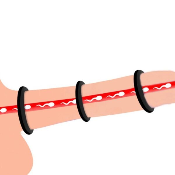 Kırmızı Penis Halkası Seti 3 Boy
