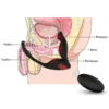 Penis Halkalı Prostat Şarjlı Uzaktan Kumandalı Anal Vibratör