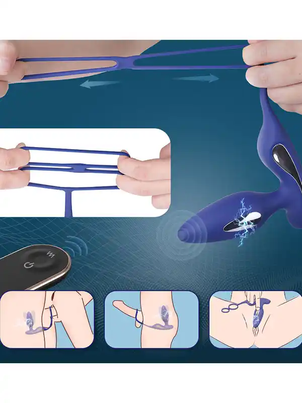 Penis Halkalı Prostat ve Elektro Şok Özellikli Anal Vibratör